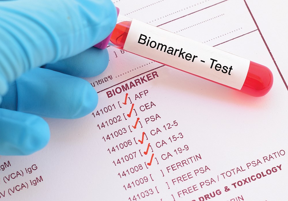Biomarker test tube on a laboratory requisition form